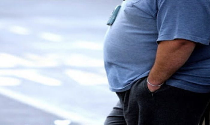 Pessoa que sofre de obesidade