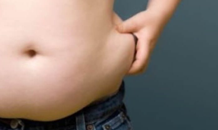 Jovem com obesidade